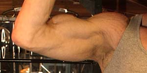 right arm